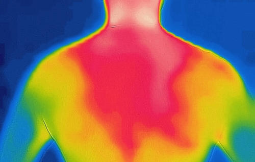 Thermografie Diagnostik